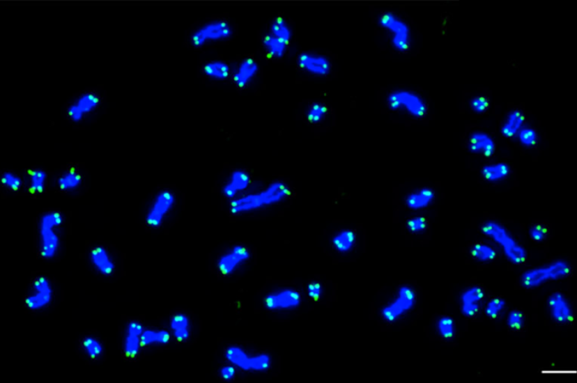 Karyotype from a human cell with 46 chromosomes at metaphase