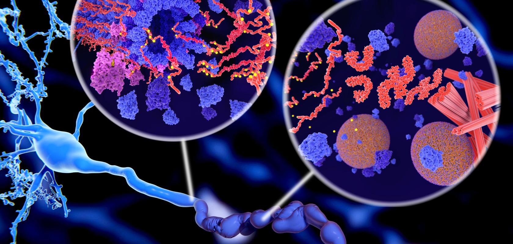 Image of protein aggregation of the pathological Tau protein (red-orange) to neurofibrillary tangles (orange) in a neuron axon in Alzheimer’s disease (Image:Shutterstock/Juan Gaertner)