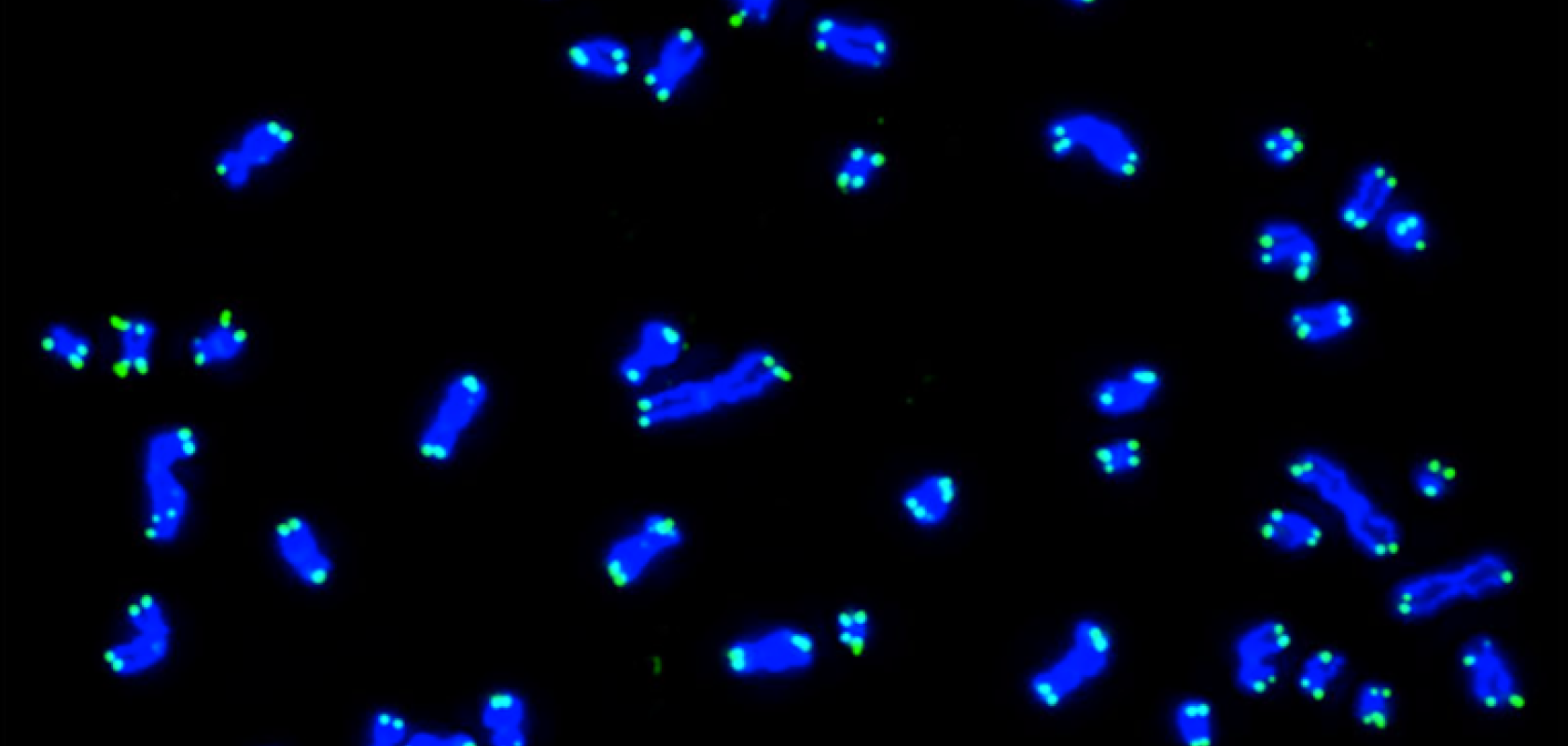 Karyotype from a human cell with 46 chromosomes at metaphase